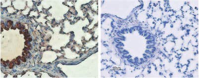 Anti-CFTR Antibody