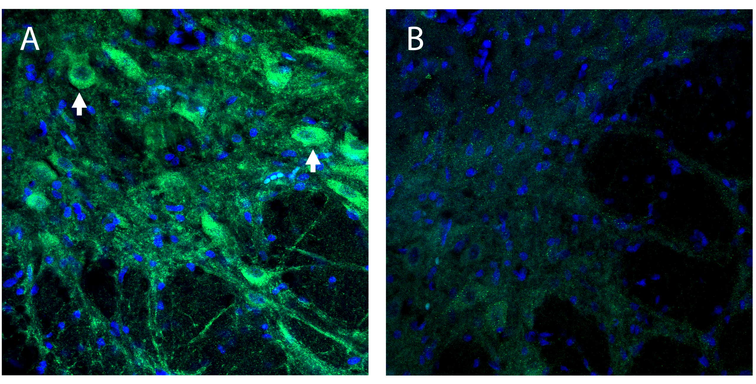 Anti-TMEM16A (ANO1) (extracellular) Antibody