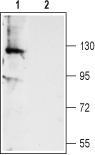 TMEM16A/ANO1 (extracellular) Blocking Peptide