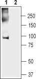 Anti-Anoctamin-5 Antibody