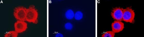 Anti-CLIC1 Antibody