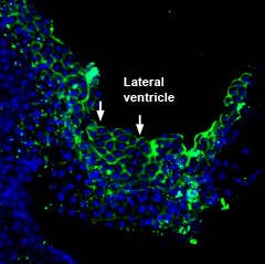 Anti-PMCA3 Antibody