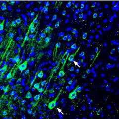 Anti-PMCA4 Antibody