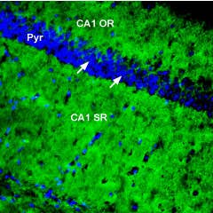 Anti-PMCA1 Antibody