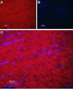 Anti-SERCA1 Antibody