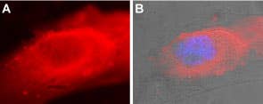 Anti-SERCA2 Antibody