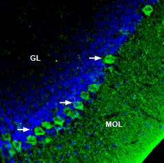 Anti-SERCA3 Antibody