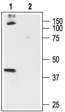 Cannabinoid Receptor 1 (extracellular) Blocking Peptide