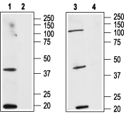 Human Cannabinoid Receptor 2 (extracellular) Blocking Peptide