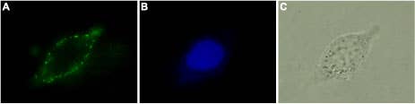 Anti-Human Cannabinoid Receptor 2 (extracellular) Antibody