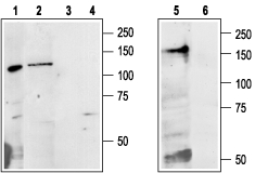 Anti-Calcium Sensing Receptor (extracellular) Antibody - Carrier Free