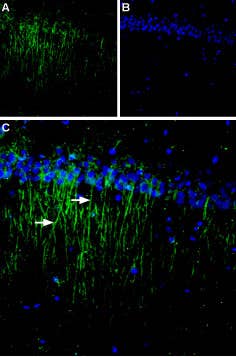 Anti-Calcium Sensing Receptor (extracellular) Antibody