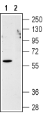 Human CXCR1 (extracellular) Blocking Peptide