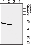Human CCR2 (extracellular) Blocking Peptide