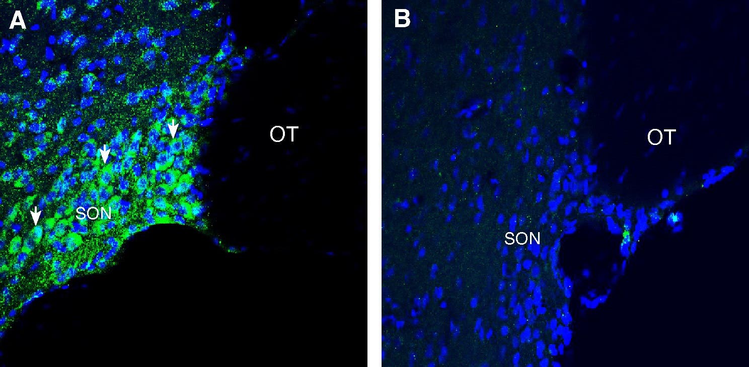 Anti-Rat CMKLR1 (extracellular) Antibody