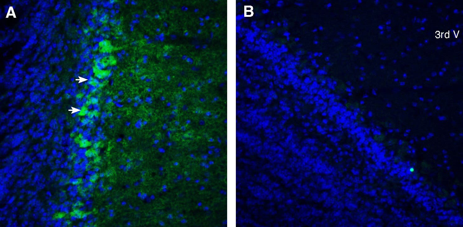 Anti-CXCR7 (ACKR3) (extracellular)-ATTO Fluor-488 Antibody