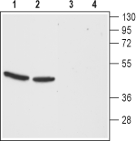 CCKBR (extracellular) Blocking Peptide