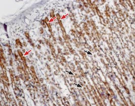 Anti-CCKBR (extracellular) Antibody