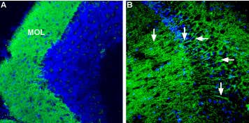 Anti-CRF1/CRHR1 (extracellular) Antibody