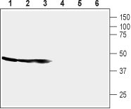 CRF1/CRHR1 (extracellular) Blocking Peptide
