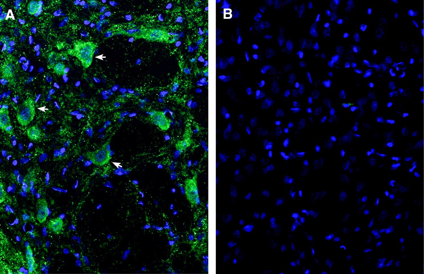 Anti-CRF2/CRHR2 (extracellular) Antibody