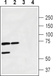 Calcitonin Receptor (extracellular) Blocking Peptide