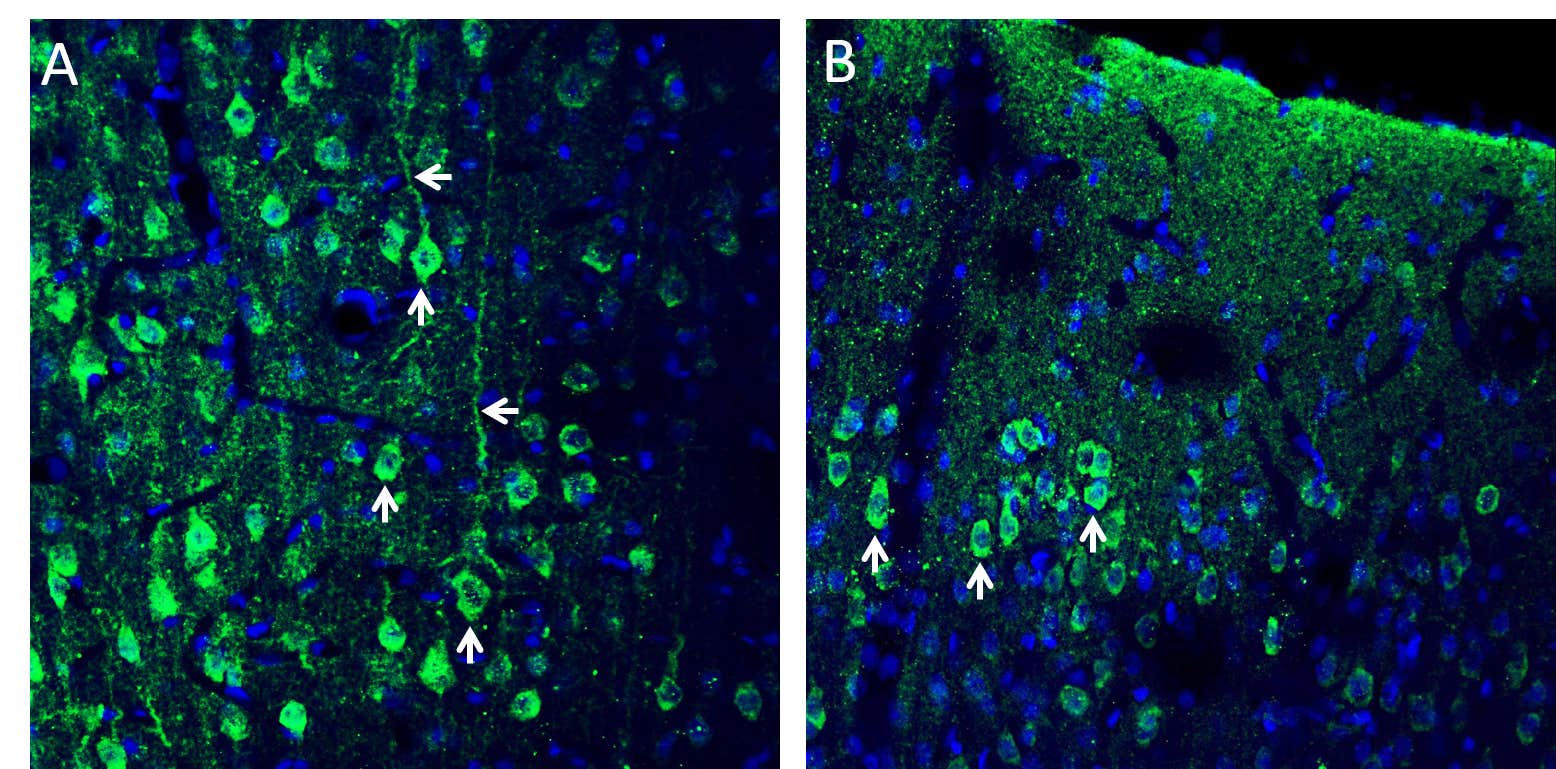 Anti-CX3CL1 (extracellular) Antibody