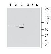 CX3CR1 (extracellular) Blocking Peptide