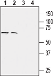 Human CX3CR1 (extracellular) Blocking Peptide
