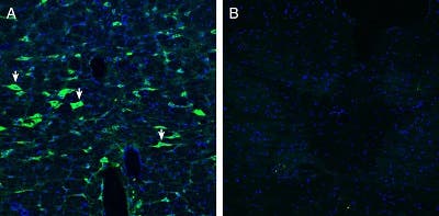 Anti-CRLR/CALCRL (extracellular) Antibody