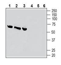 CRLR/CALCRL (extracellular) Blocking Peptide