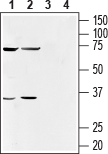 Human GPR55 (extracellular) Blocking Peptide