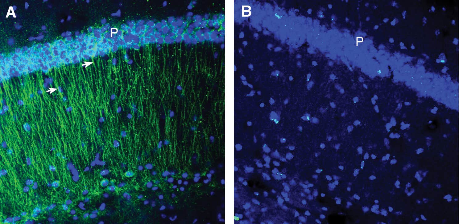 Anti-CCR2 (extracellular) Antibody
