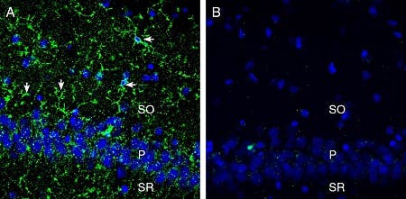 Anti-CX3CR1 (extracellular) Antibody