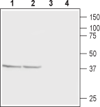 CaBP1 Blocking Peptide
