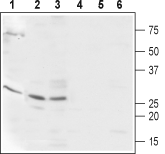 CaBP2 Blocking Peptide