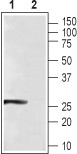 Anti-CaBP4 Antibody