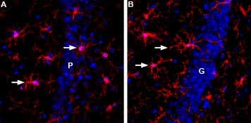 Anti-IBA1/AIF1 Antibody