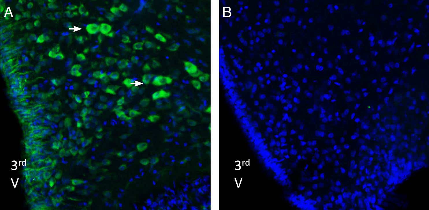 Anti-Nucleobindin-2/Nesfatin-1 Antibody