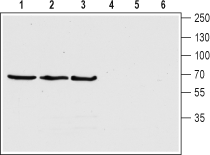 Choline Transporter/SLC5A7 (extracellular) Blocking Peptide