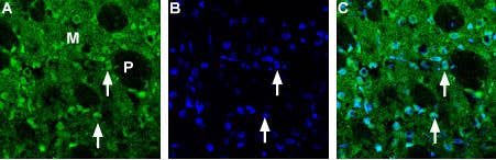 Anti-Choline Transporter (SLC5A7) (extracellular) Antibody