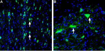 Anti-Vesicular Acetylcholine Transporter (VAChT) Antibody