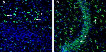 Anti-SLC22A3 (extracellular) Antibody