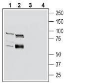 OCTN1/SLC22A4 Blocking Peptide