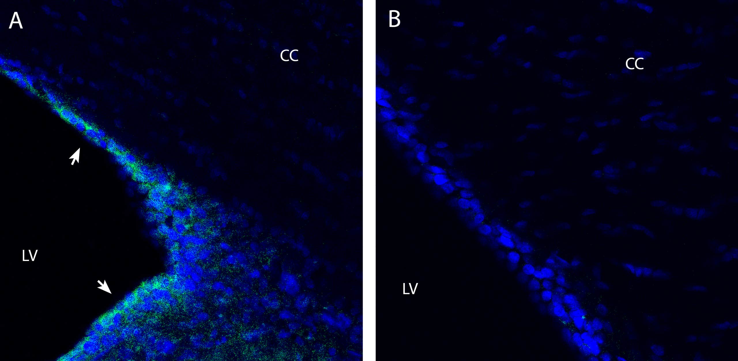 Anti-OCTN2/SLC22A5 Antibody