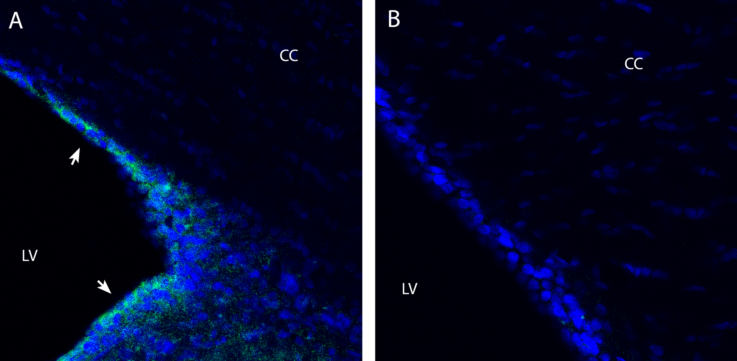 OCTN2/SLC22A5 Blocking Peptide