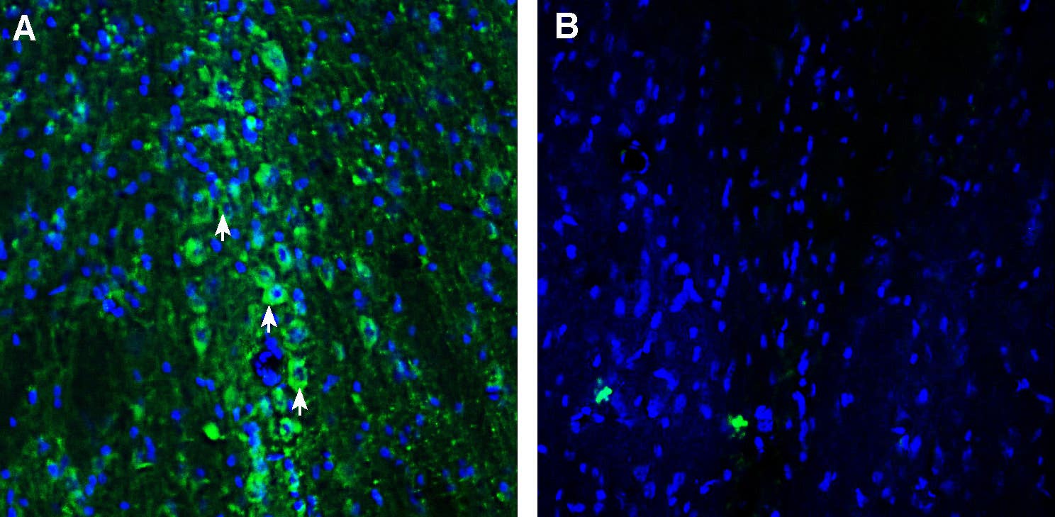 Anti-SLC22A2 (OCT2) Antibody
