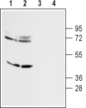 Anti-D<sub>4</sub> Dopamine Receptor Antibody