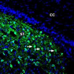 Anti-DARPP32 Antibody