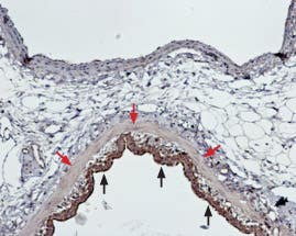 Anti-Endothelin Receptor A Antibody